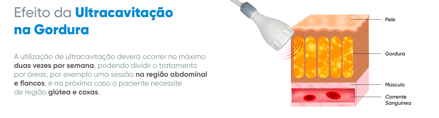 efeito da ultracavitação 