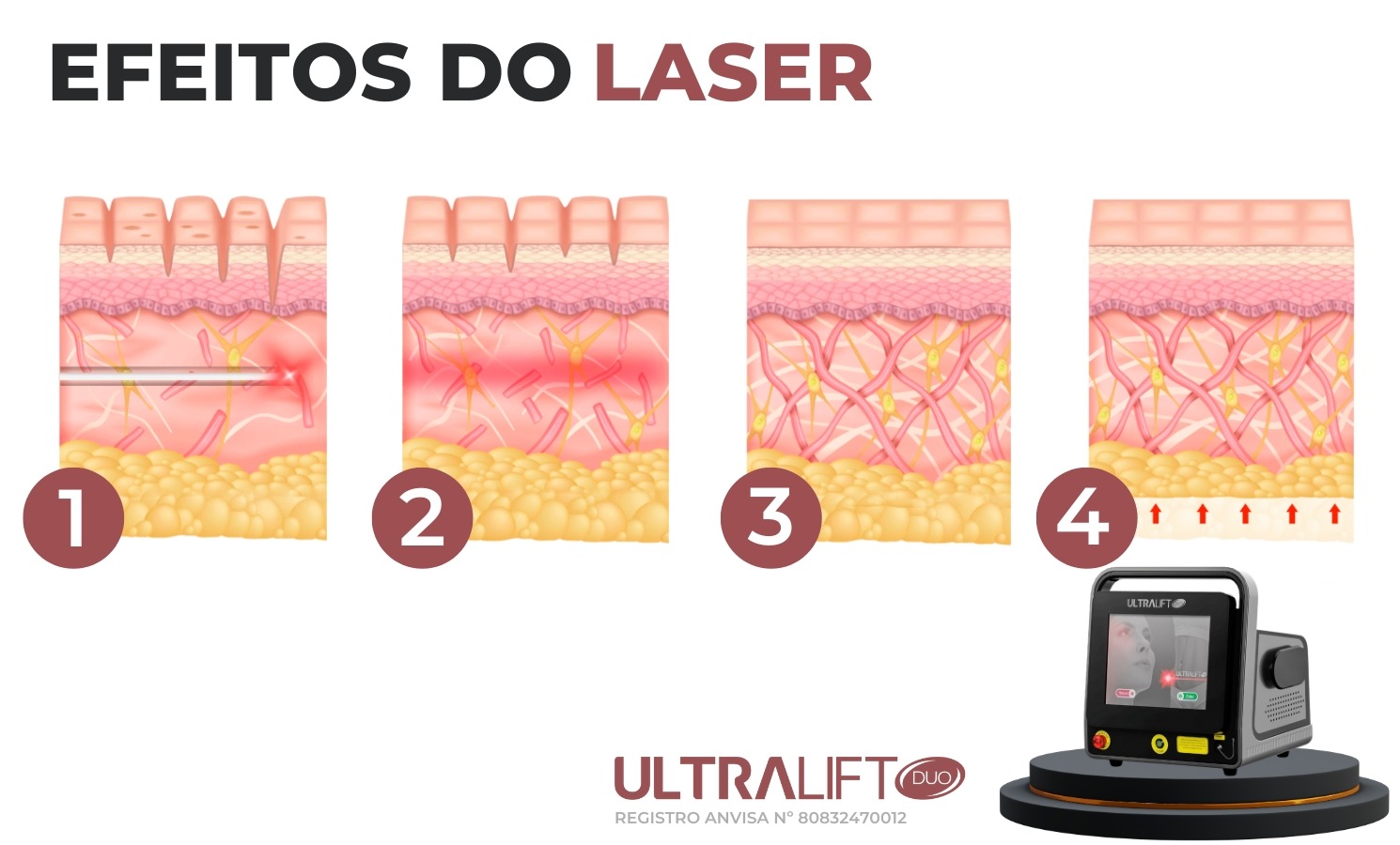 ultralift duo efeitos do laser contourline bcmed