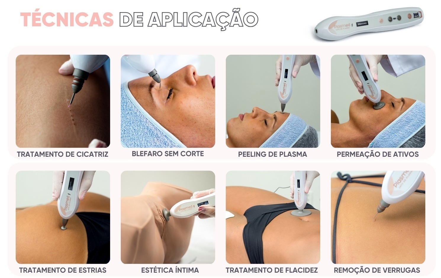 TÉCNICAS DE APLICAÇÃO PLASMED ibramed na BCMED