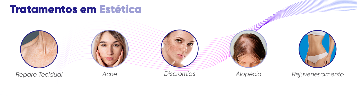 tratamentos de estética