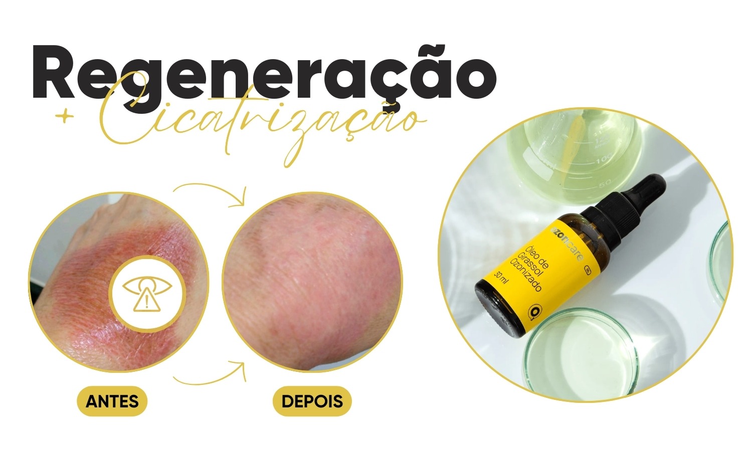 antes e depois óleo de girassol ozonizado