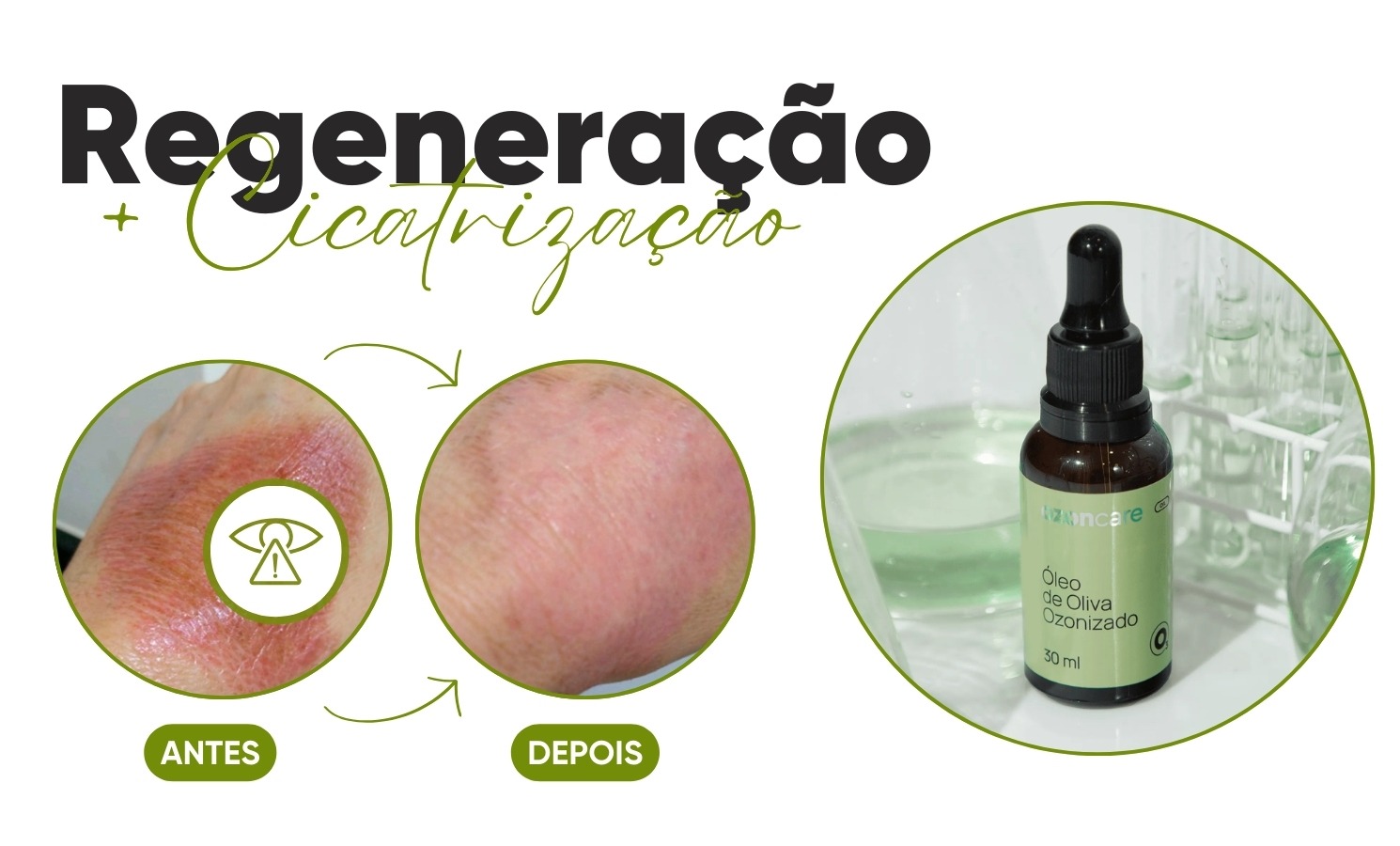 Óleo de Oliva Ozonizado - antes e depois