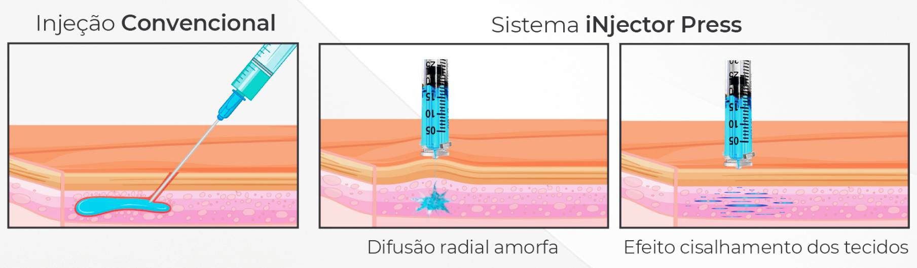 Flyer comparando o funcionamento de uma injeção normal para o da iNjector Press