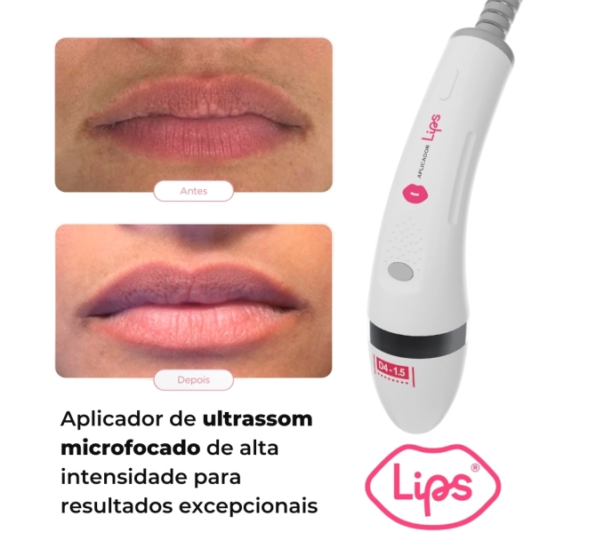 Aplicador Lips para Aparelhos Ultrassom Ultramed - Medical San