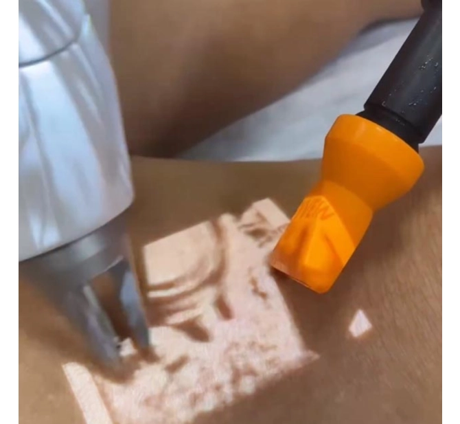 Freddo - Resfriador de Pele - Fabinject Technology 
