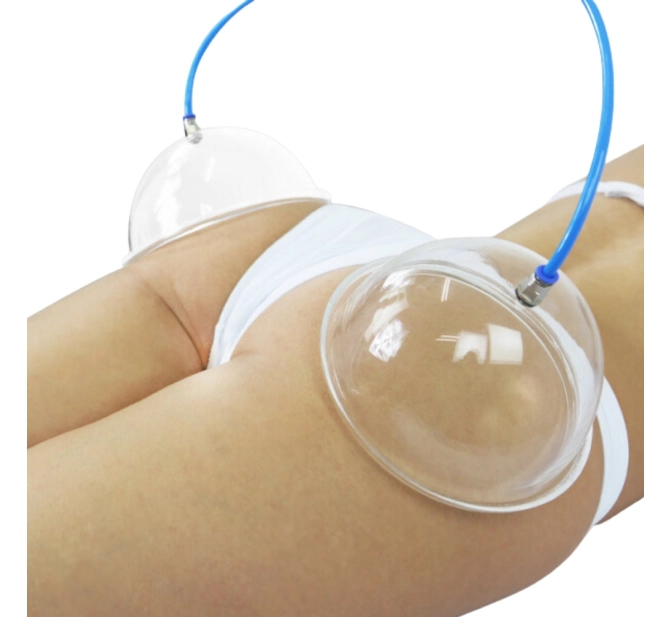 Kit de 4 Ventosas para Pump Up de Glúteos - BCMED