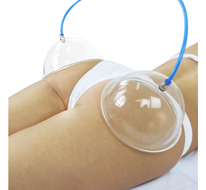 Kit de Ventosas para Glúteos Pump Up - BCMED