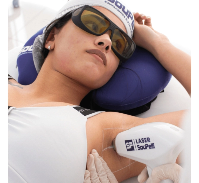 Mini Premium - Aparelho de Epilação a Laser de Diodo- SouPelli