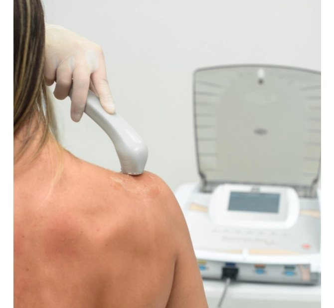 Sonopulse II System - Ultrassom Terapêutico e Correntes - IBRAMED