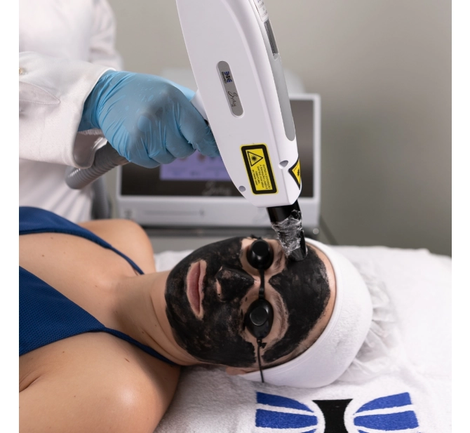 Syrius Yag - Laser para Remoção de Tatuagem e Black Peel - Ibramed