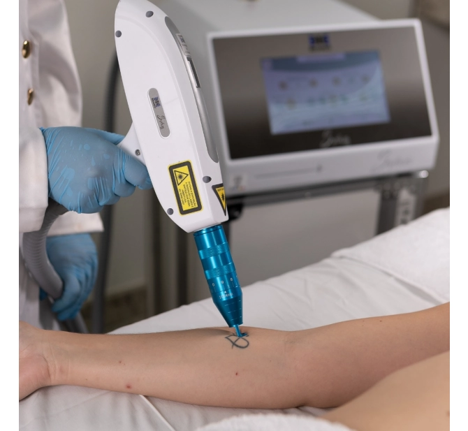 Syrius Yag - Laser para Remoção de Tatuagem e Black Peel - Ibramed