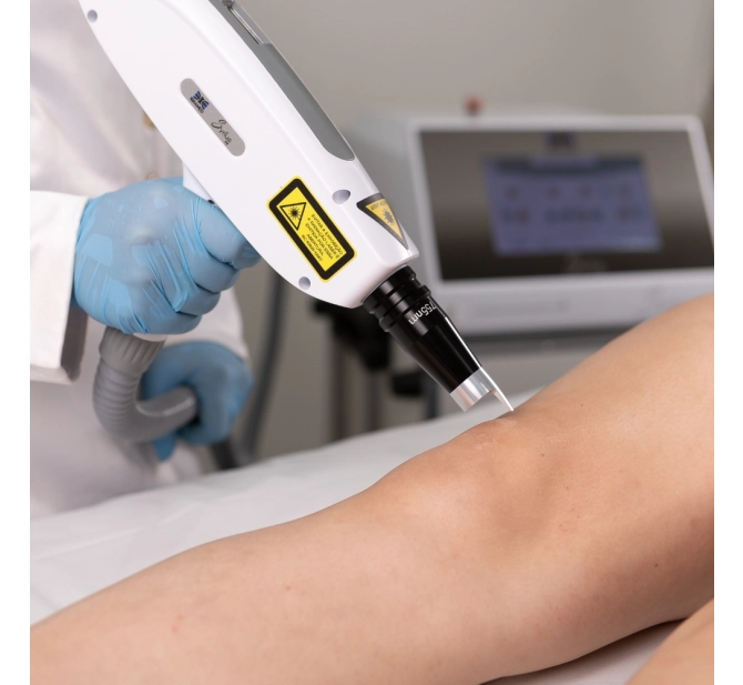 Syrius Yag - Laser para Remoção de Tatuagem e Black Peel - Ibramed