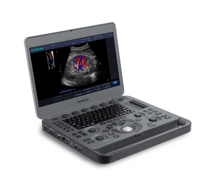 X3Pro - Aparelho de Ultrassom Portátil para Diagnóstico por Imagem - SonoScape