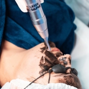 Beta Laser Premium - Laser de Picossegundo - SouPelli