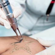 Beta Laser Premium - Laser de Picossegundo - SouPelli