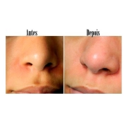 Caneta Extratora De Cravos E Espinhas - Face Clean