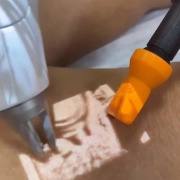 Freddo - Resfriador de Pele - Fabinject Technology 