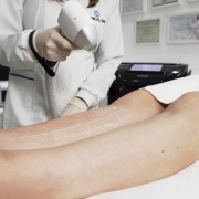 Hakon - Laser 4D de Epilação - Rubi (694nm), Alexandrite (755nm), Diodo (808nm) e ND-YAG (1064nm) - Medical San