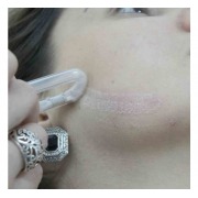 Hygiadermo Cristal KLD - Aparelho De Peeling De Cristal, Vácuo, Alta Frequência E Correntes Elétricas