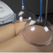 Hygiadermo Vacuo - Aparelho de Vacuoterapia - KLD