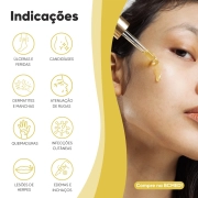 Óleo de Girassol Ozonizado 30ml com Ação Cicatrizante - Ozoncare