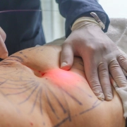 LiftEndo Endolaser de Alta Potência Dual Wave 1470nm e 980nm - Medical San