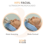 Novo Sonofocus Ibramed - Aparelho de Ultrassom Focalizado de Alta Intensidade 