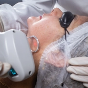 Pisom BB Laser Dual Wave de 1550nm e 1927nm p/ Tratamentos de Pele - Medical San