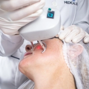 Pisom BB Laser Dual Wave de 1550nm e 1927nm p/ Tratamentos de Pele - Medical San