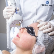 Pisom BB Laser Dual Wave de 1550nm e 1927nm p/ Tratamentos de Pele - Medical San