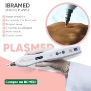 Plasmed - Caneta de Jato de Plasma Portátil - IBRAMED