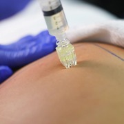 Smart Mesofill 2,0 mm - Cartucho com 5 microagulhas 32 g - Caixa com 20 Unidades - Smart GR 