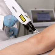 Syrius Yag - Laser para Remoção de Tatuagem e Black Peel - Ibramed