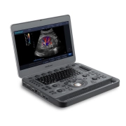 X3Exp - Aparelho de Ultrassom Portátil para Diagnóstico por Imagem - SonoScape